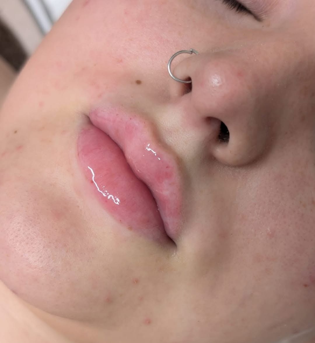Glossy, fuller lips from a three quarter angle