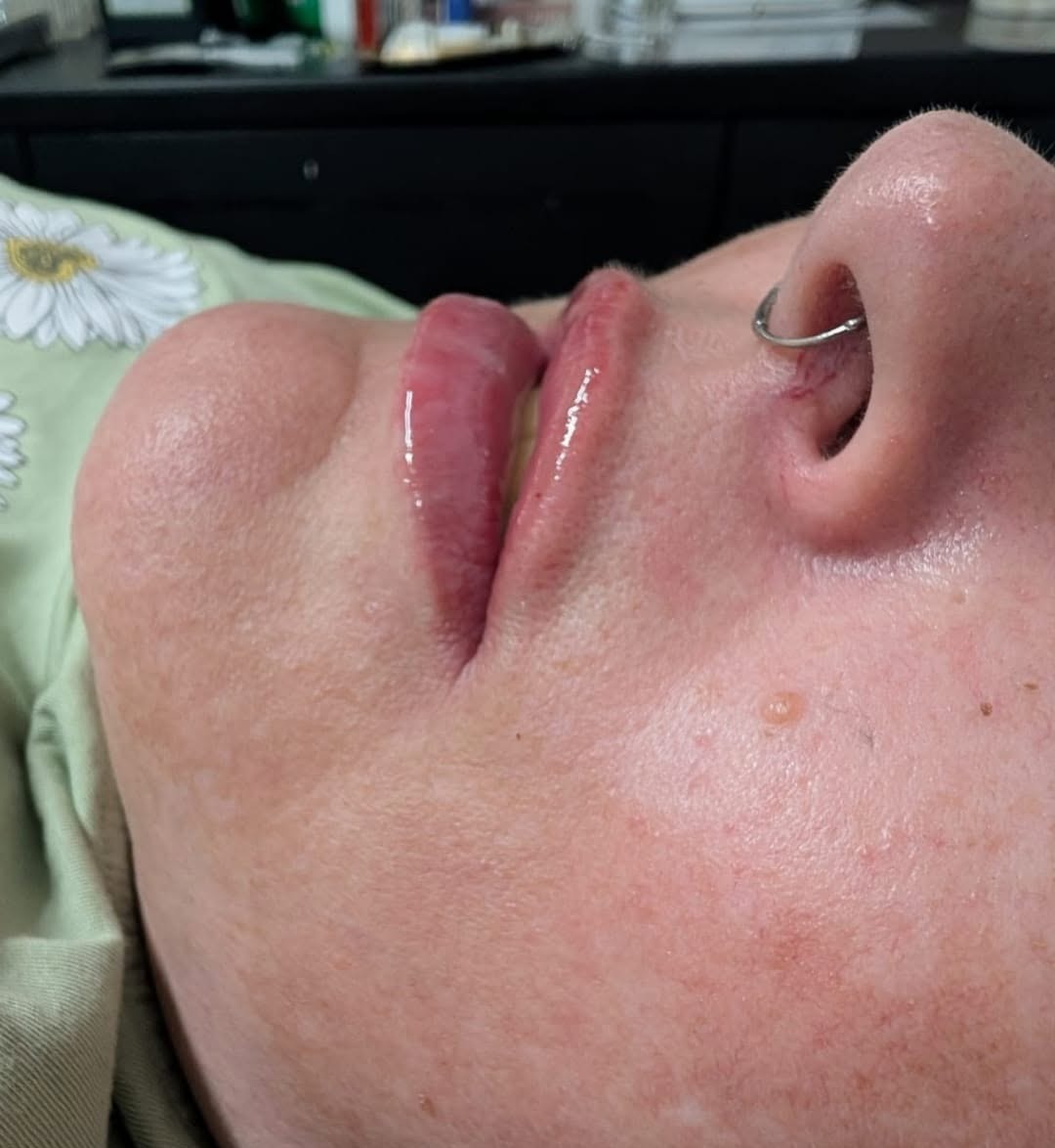 A client's lips in profile in the treatment chair at House of Envy