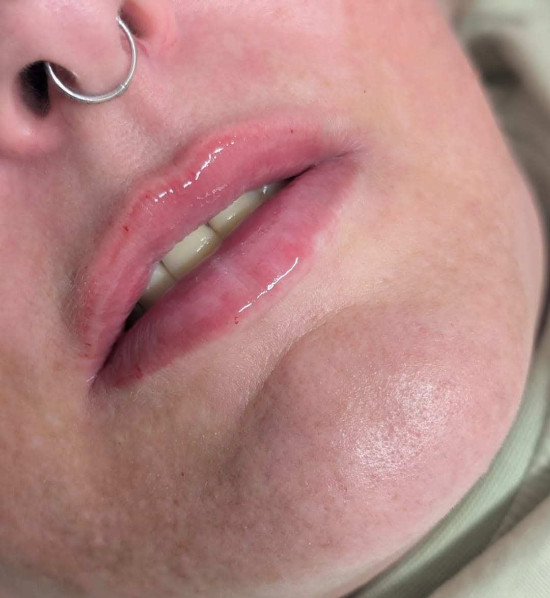 Fuller lips, close up